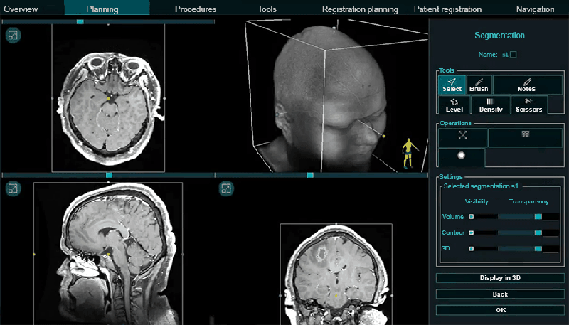 Neuronavigator: optical navigation system for neurosurgeons